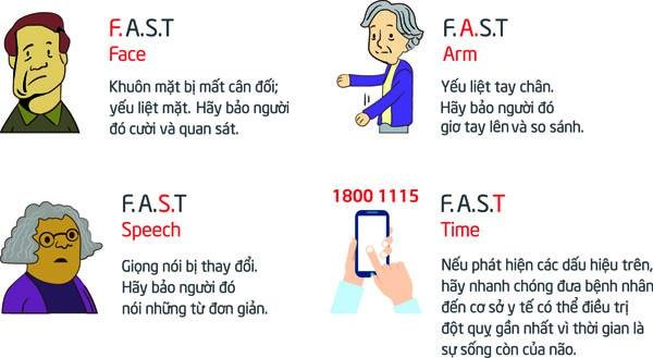 Cần sơ cứu người bị đột quỵ như thế nào cho đúng cách