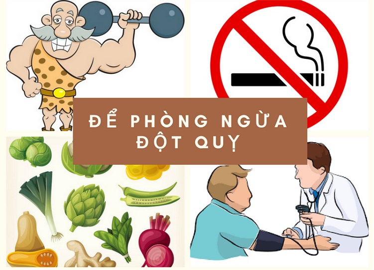 Nguyên nhân gây đột quỵ não là gì? Cách phòng ngừa đột quỵ não